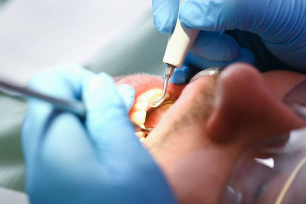 Best Walk-In Emergency Dentist in Big Bass Lake, PA